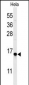 GABARAPL1 Antibody